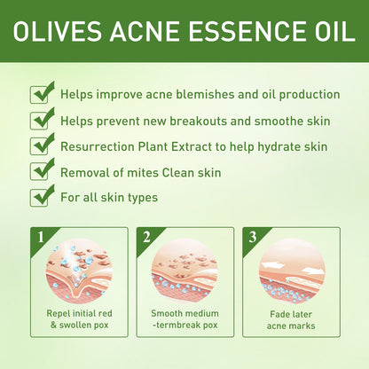 Remove Face Oil Acne Gentle Moisturizing Acne Pit Repair Liquid Fade Face Acne Marks Essential Oil